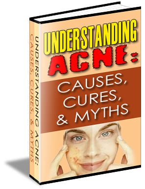 Understanding Acne Causes, Cures, And Myths